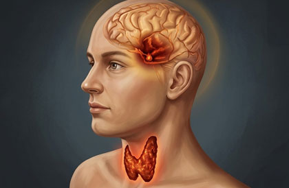 Head and Neck Cancer