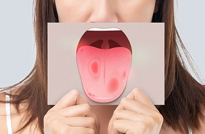 Oral Cancer Awareness