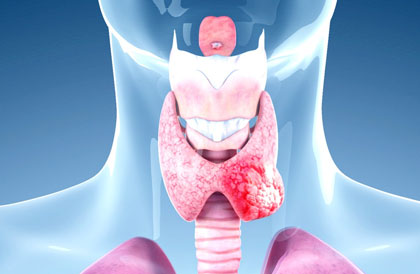 Thyroid Cancer Treatment