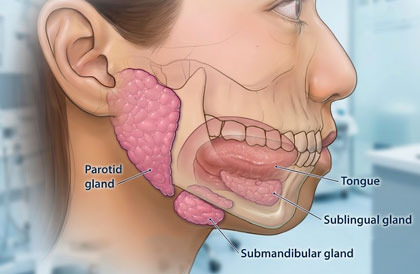 Parotid Tumour Surgery